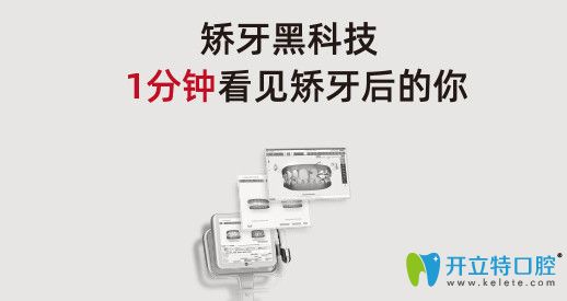 蘇州口腔醫(yī)院矯正黑科技iTero