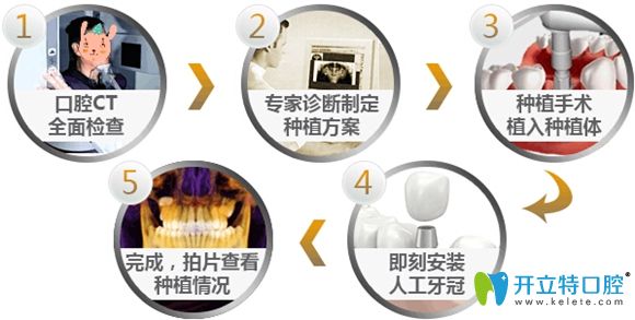 即刻種植牙修復步驟圖