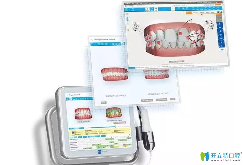 北京佳美口腔做正畸口掃設(shè)備