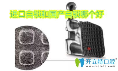 金屬自鎖托槽是國產(chǎn)還是進口的好