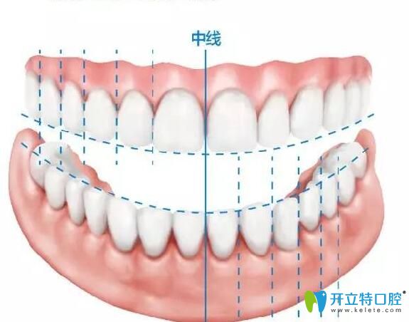 成都極光口腔牙齒矯正注重美學(xué)設(shè)計(jì)