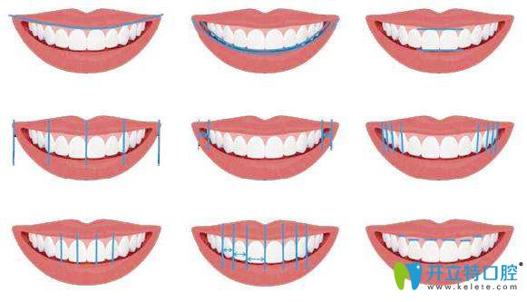 泉州美萊口腔美學(xué)正畸微笑弧線設(shè)計(jì) 泉州美萊口腔美學(xué)正畸微笑弧線設(shè)計(jì)