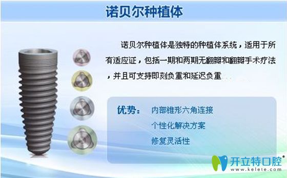 諾貝爾種植體優(yōu)勢(shì)宣傳圖 諾貝爾種植體優(yōu)勢(shì)宣傳圖