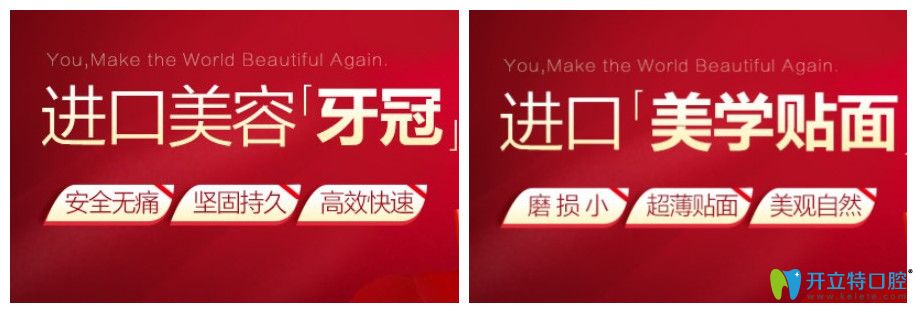 寧波藝星口腔進(jìn)口牙齒貼面價格