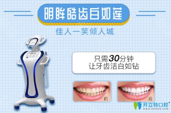 寧波藝星皓齒美白價格
