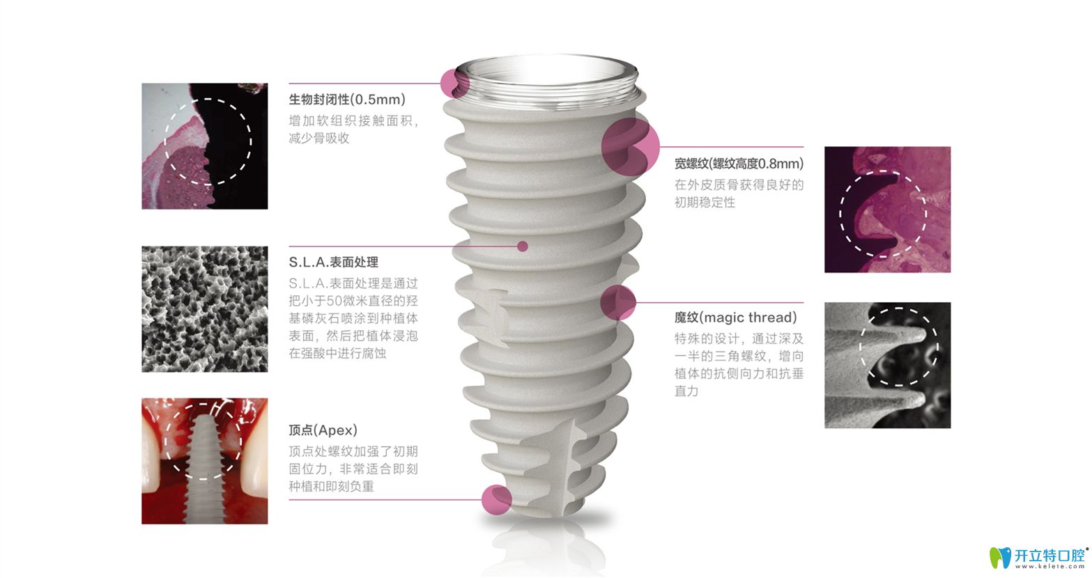 韓國紐百特種植體優(yōu)勢介紹