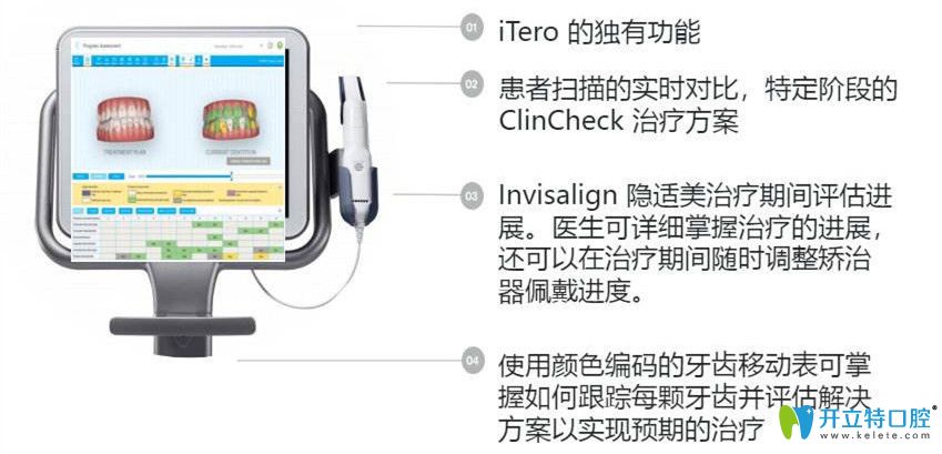 iTero口內(nèi)掃描儀優(yōu)勢