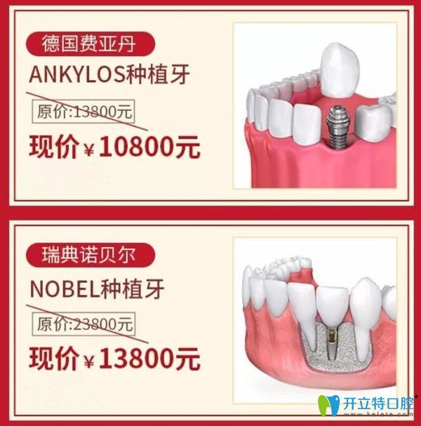 東莞好佰年口腔德國種植牙價格