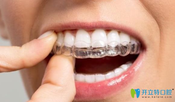 寧波壹加壹口腔隱形矯正技術(shù)