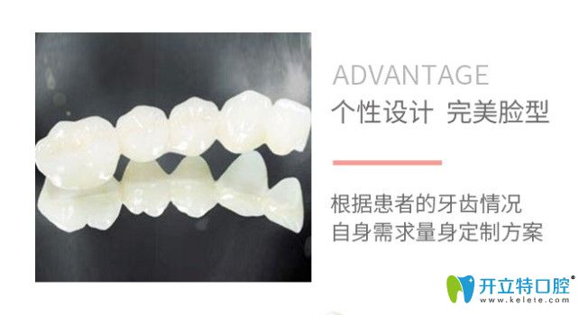 全瓷牙進(jìn)口和國(guó)產(chǎn)區(qū)別是什么