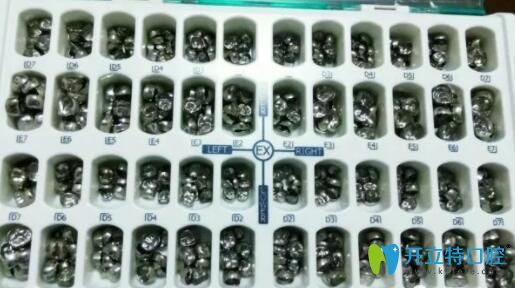 選擇合適預成冠