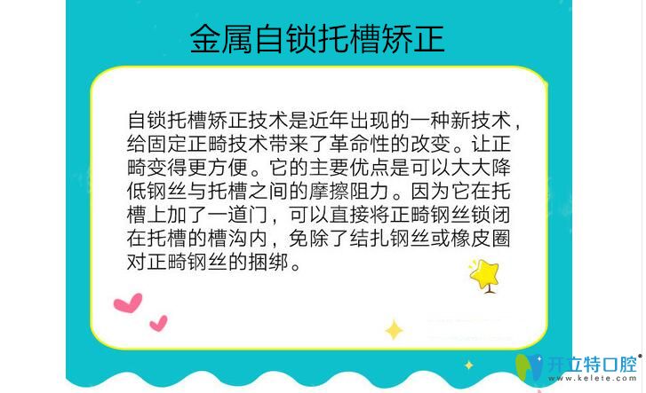 金屬自鎖托槽矯正介紹