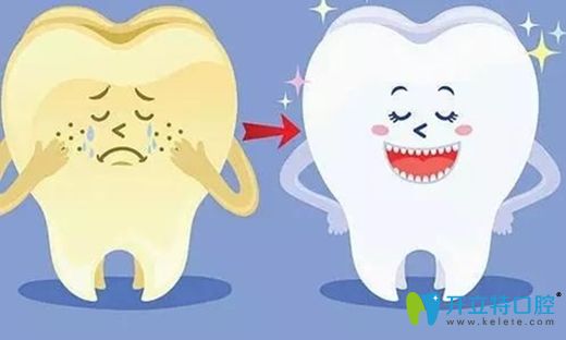 何紅醫(yī)生講解牙齒冷光美白的優(yōu)勢(shì)