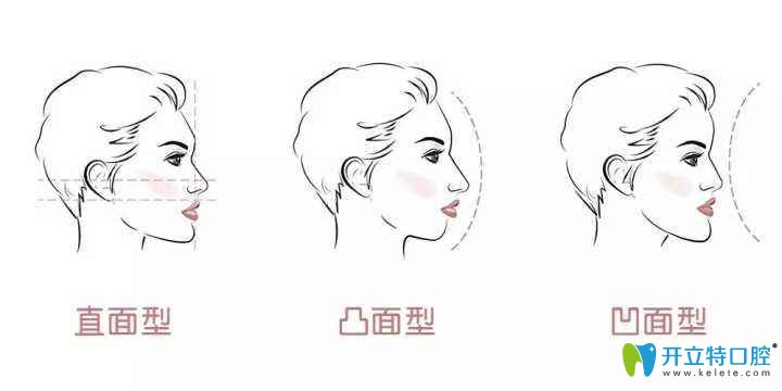 看到北京美萊口腔時(shí)代天使矯正器和隱適美牙套價(jià)格并不貴