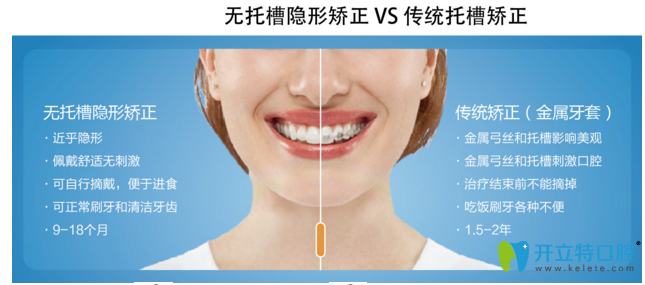 隱形矯正和傳統(tǒng)矯正