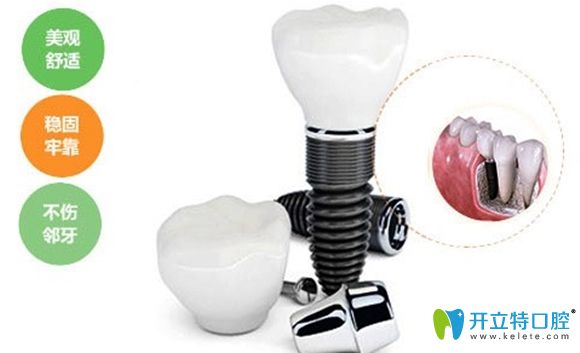 一顆種植牙價(jià)格包含有種植體和基臺(tái)以及牙冠