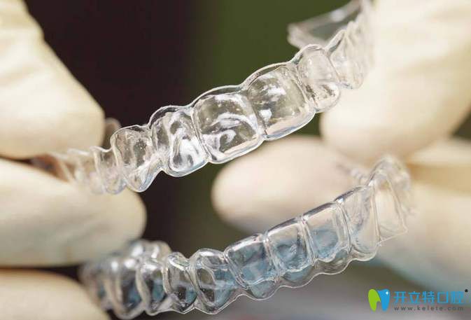 入選可享隱形牙套優(yōu)惠價(jià)格