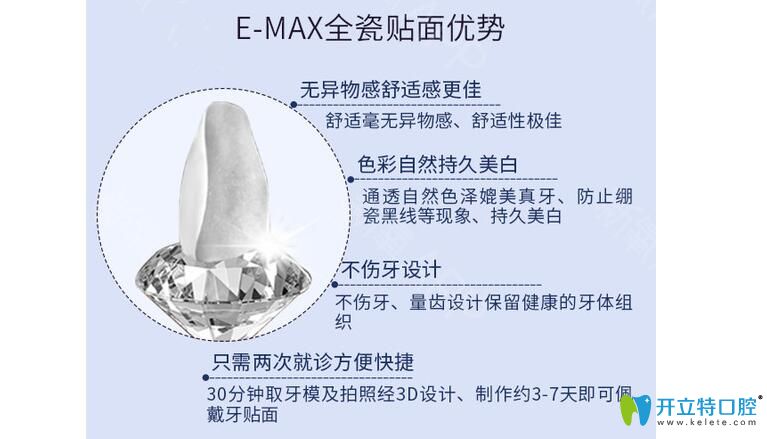 emax牙貼面優(yōu)勢(shì)介紹
