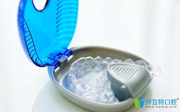 隱適美隱形牙套展示圖