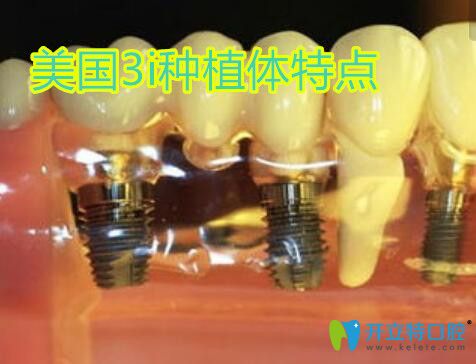 美國3i種植牙特點