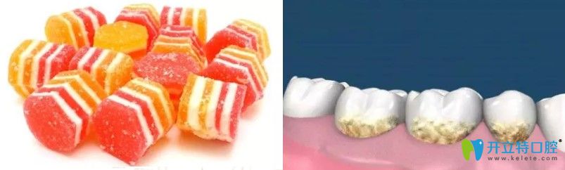 兒童有蛀牙是什么原因造成的