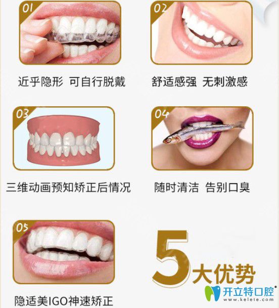 隱適美IGO隱形矯正優(yōu)勢(shì)