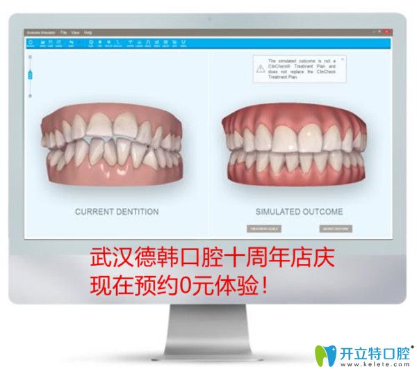 哇!隱形矯正黑科技