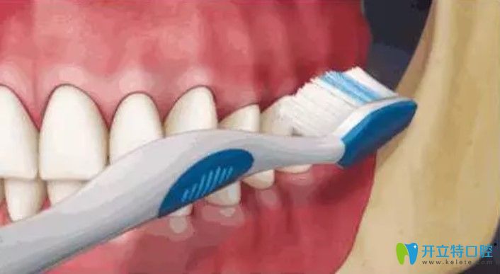 牙結石的危害有哪些