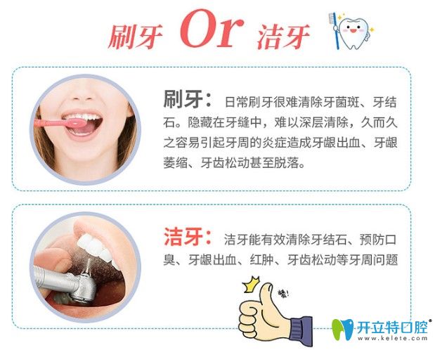 牙結石是怎樣產(chǎn)生的