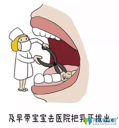 雙排牙改善方式