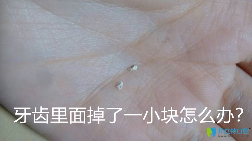 Duang！牙齒里面掉了一小塊怎么辦要補(bǔ)嗎