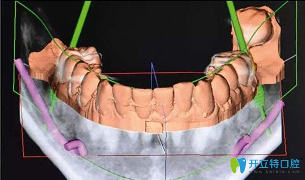 數(shù)字化種植技術(shù)