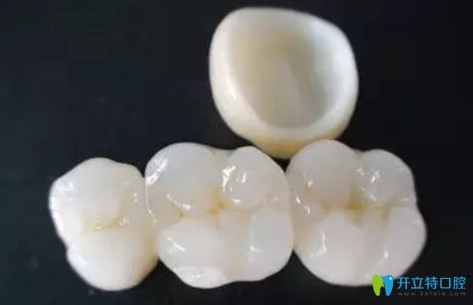 為啥牙醫(yī)建議做二氧化鋯全瓷牙，原來(lái)竟是因?yàn)檫@些...