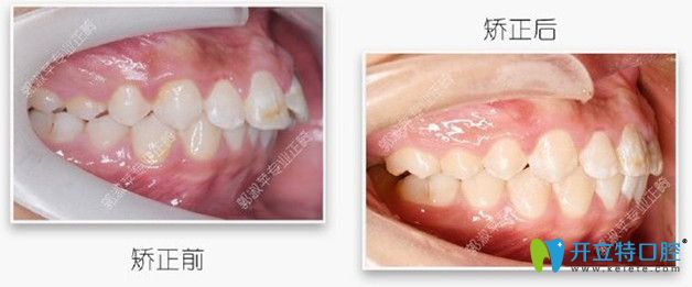 對(duì)比下矯正前后的照片，效果還是不錯(cuò)吧