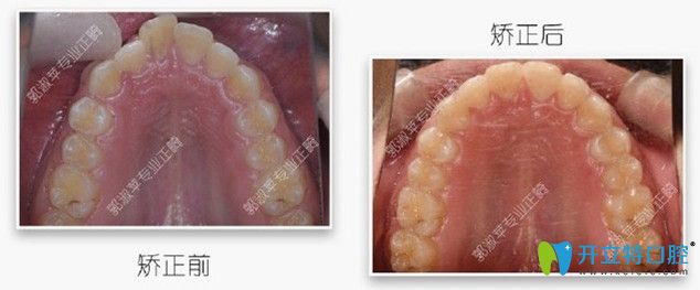 矯正時(shí)，選對(duì)醫(yī)生很重要
