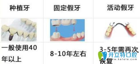 覆蓋義齒修復(fù)比種植牙價格便宜還比全口活動假牙耐用