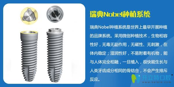 瑞典諾貝爾種植系統(tǒng)優(yōu)點(diǎn)