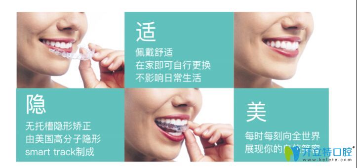 隱適美隱形矯正的介紹