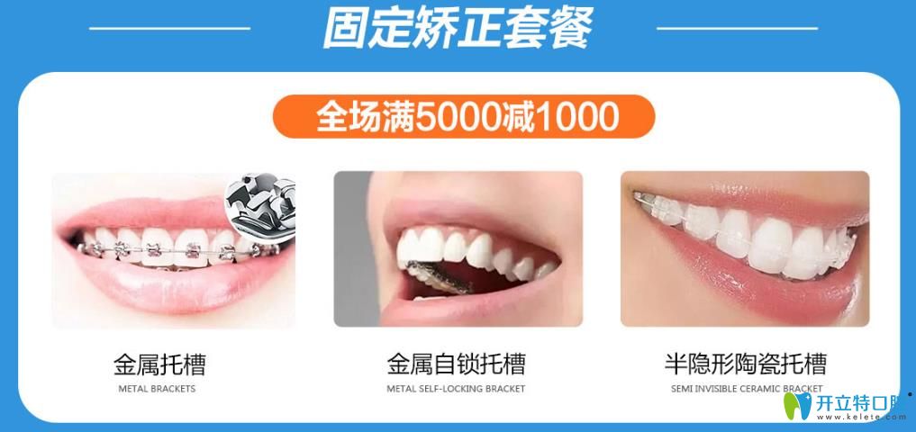 蘭州皓亞口腔固定矯正活動