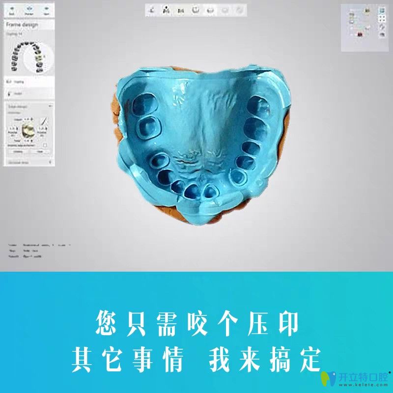 博世達(dá)隱形牙套具備其他品牌隱形牙套所不具備的優(yōu)勢(shì)
