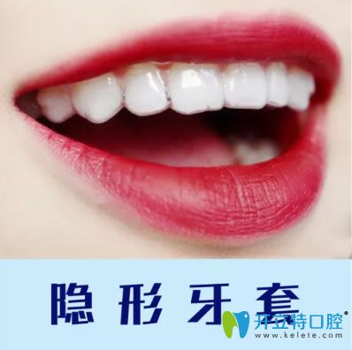重慶維樂(lè)口腔隱形牙套
