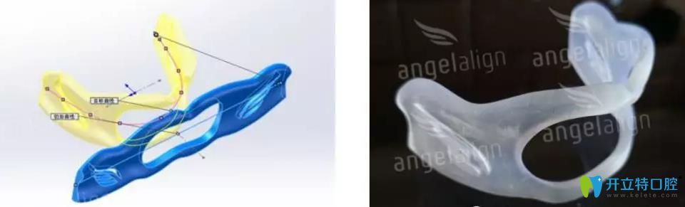 時(shí)代天使kid矯正器外觀