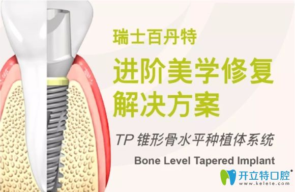 認(rèn)真看完這篇介紹,你對(duì)瑞士百丹特種植體就不覺得陌生了