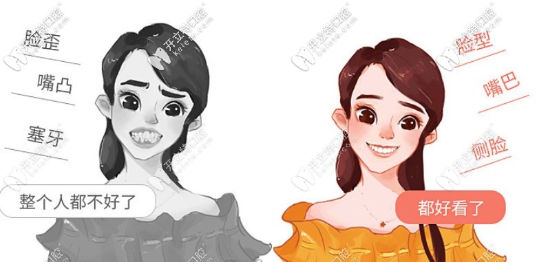 正畸“新玩法”，三場(chǎng)免費(fèi)試戴隱形牙套的機(jī)會(huì)來啦~