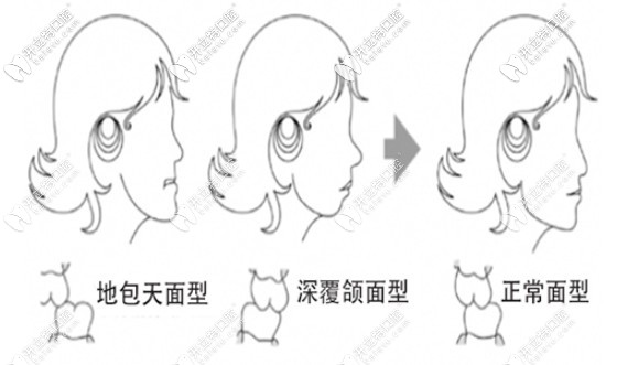 做牙齒矯正的優(yōu)勢
