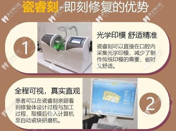 瓷?？碳纯绦迯?fù)的優(yōu)勢(shì)