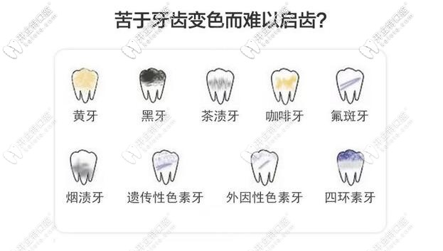 哪幾種牙齒需要做冷光美白