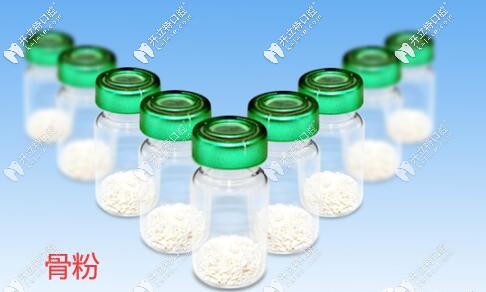 覺得種植牙填進(jìn)口Bioss骨粉價(jià)格貴的人建議看看與國(guó)產(chǎn)的區(qū)別