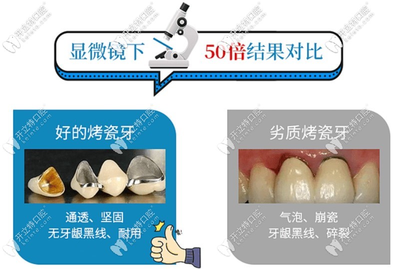 牙縫變大可以補嗎