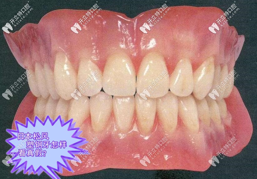 日本的松風塑鋼牙真假怎樣區(qū)別